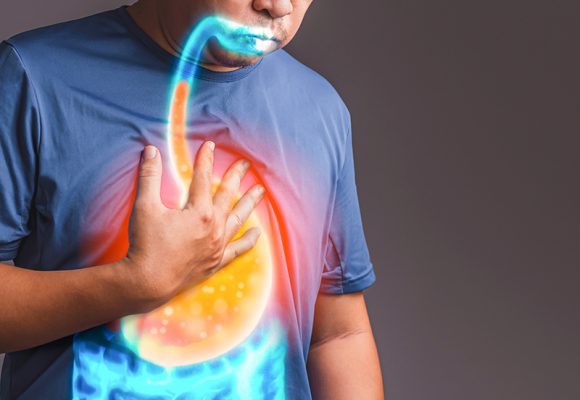 Gastro Özofajial Reflü Hastalığı ve Tedavi Yöntemleri